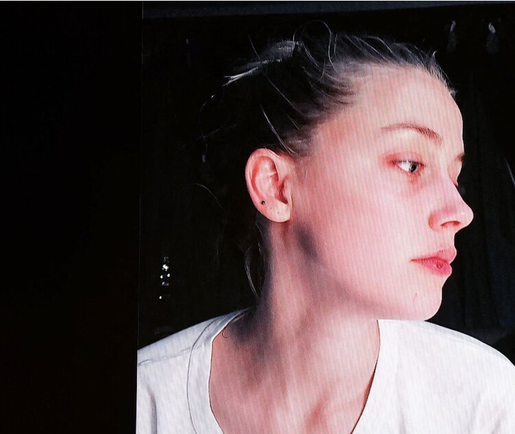 Следы от ударов Джонни Деппа предоставленные на суде, 2022