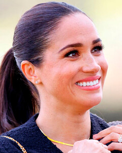 Что Меган Маркл сделала со своими зубами?