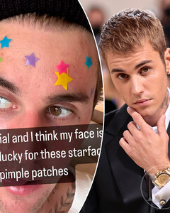 «Я думаю, что моё лицо очищается»: Джастин Бибер поделился откровенным селфи с акне