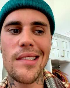 Джастину Биберу всё тяжелее есть из-за паралича — симптома синдрома Рамсея Ханта