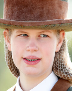 Раскрыты причины редкого заболевания глаз леди Луизы