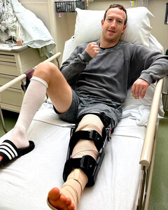 Марк Цукерберг порвал связку во время тренировки