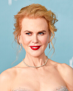 Николь Кидман пропустила обед номинантов «Оскара» из-за разрыва подколенного сухожилия