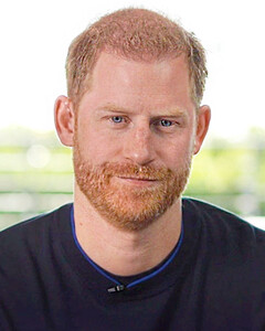 Принц Гарри лысеет: у внука Елизаветы II стремительно выпадают волосы, как и у его брата — принца Уильяма